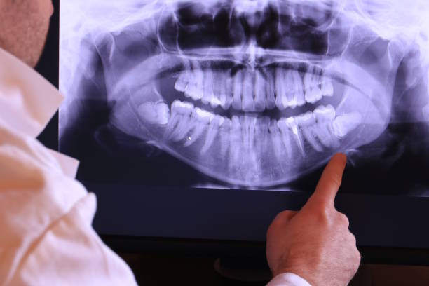 Best Emergency Dental Care for Broken or Chipped Teeth in Maple Glen, PA